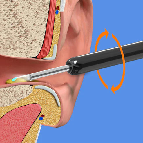 Bâtonnets d'oreille intelligents