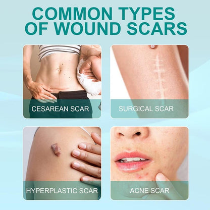 Scar Remove Spray
