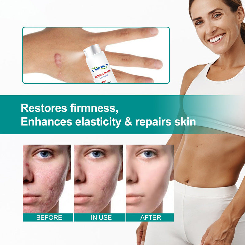 Scar Remove Spray
